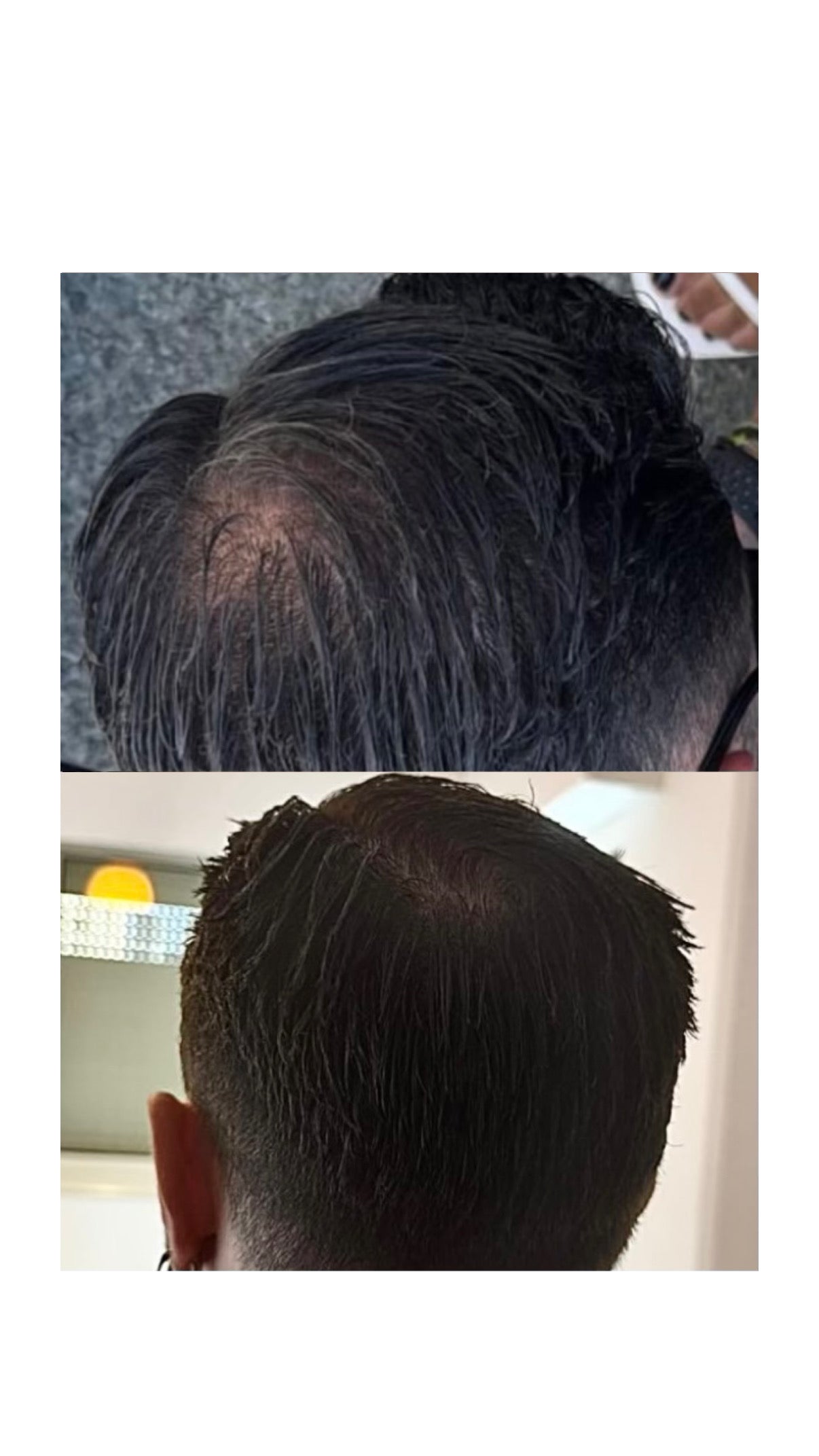 <p>Scalp & Roots Hair Oil</p>