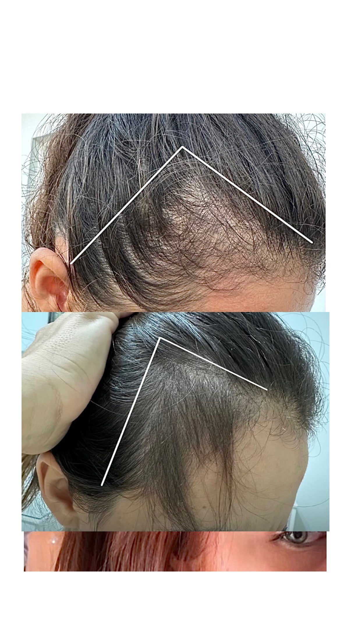 <p>Scalp & Roots Hair Oil</p>